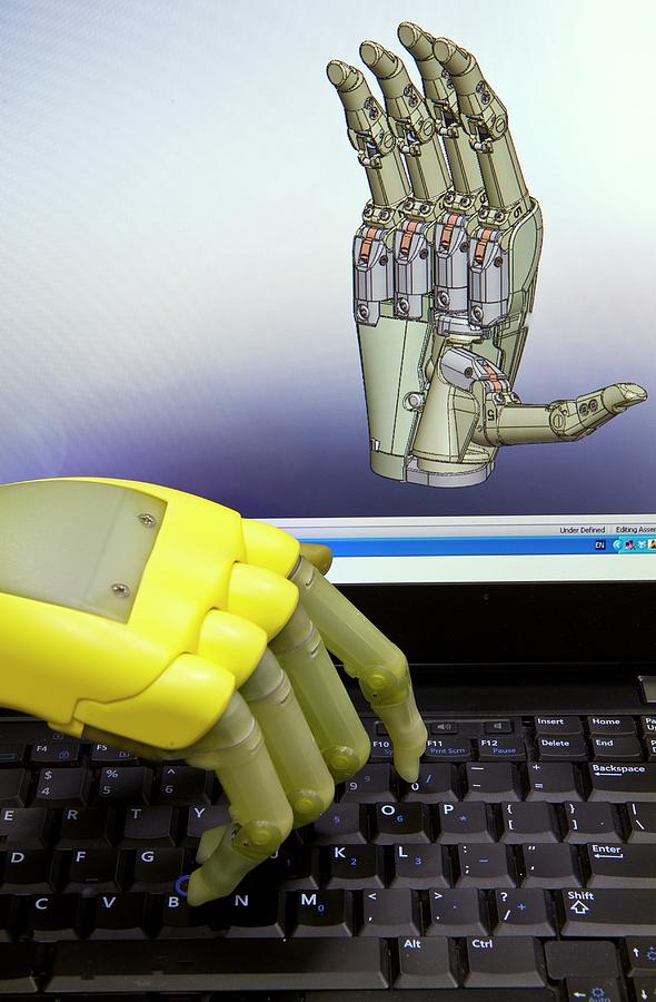 I-limb Bionic Hand Photograph by Philippe Psaila/science Photo Library