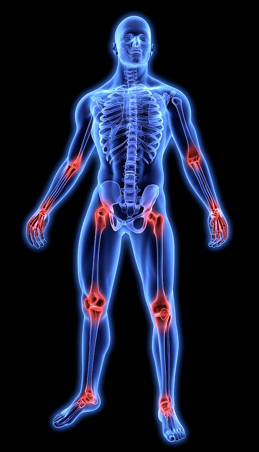 Illuminated Human Joints In Blue Photograph by Ikon Ikon Images