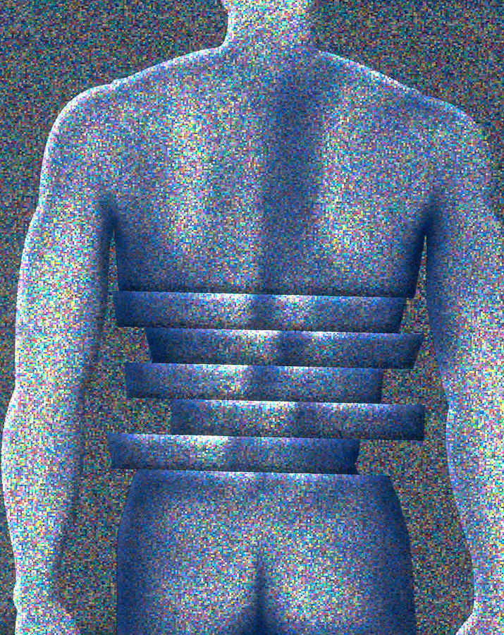 Illustration Of Back Pain Photograph by Robert S. Winter