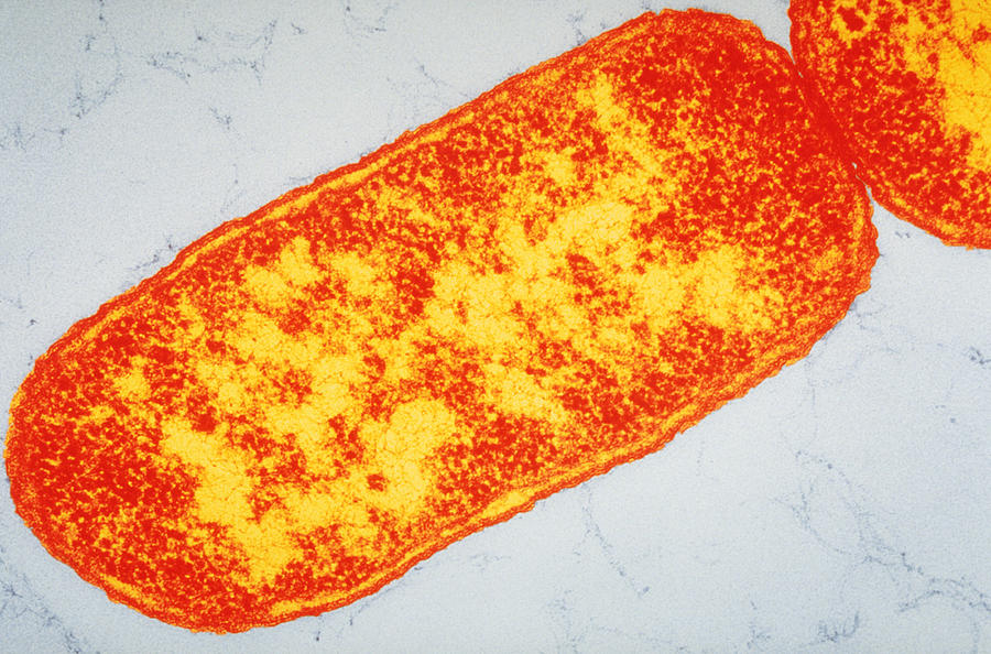 Image Of Escherichia Coli Photograph by Biology Pics