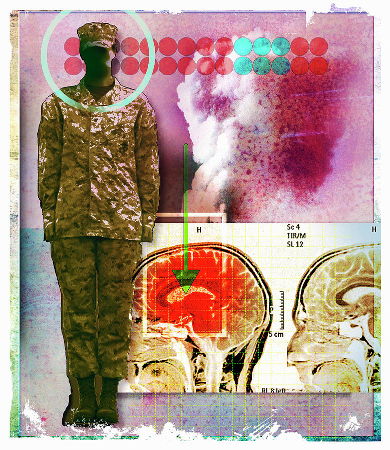 Image Of Inflamed Brain Next To Soldier Photograph by Ikon Ikon Images