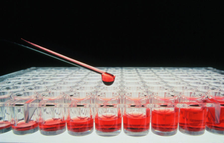 Immunoassay: Sample Wells Being Filled By Pipette Photograph by Matt Meadows/science Photo Library