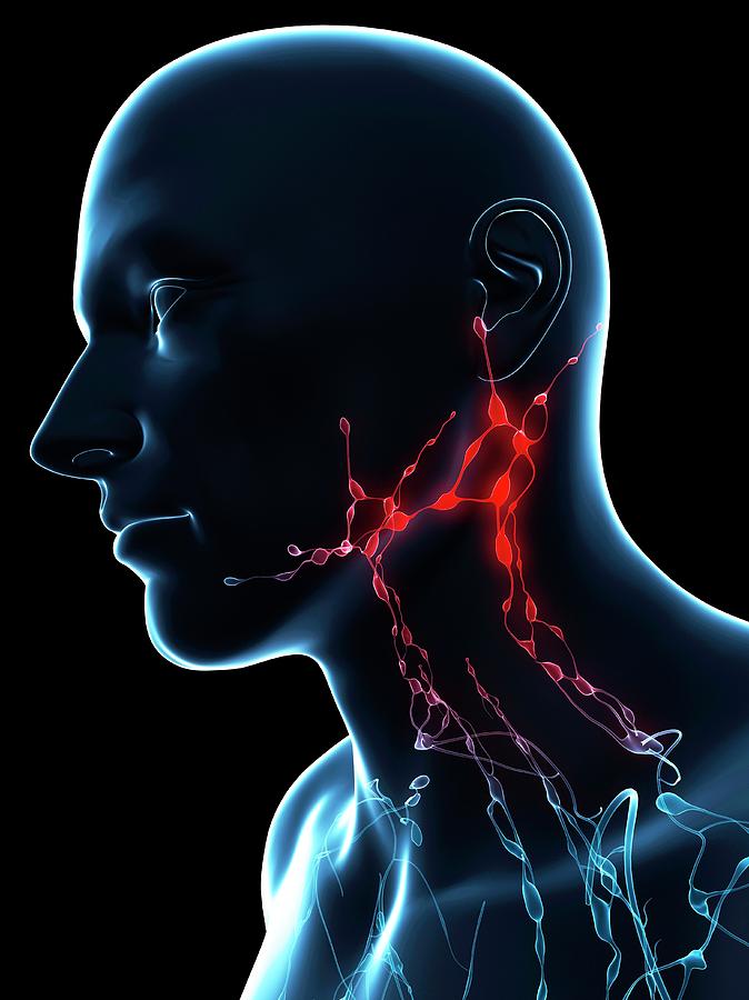 Inflamed Lymph Nodes Photograph By Scieproscience Photo Library
