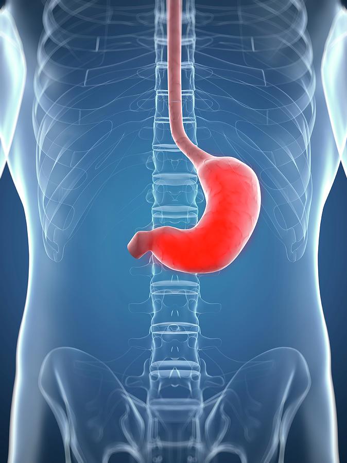 Inflamed Stomach Photograph by Sciepro/science Photo Library Fine Art