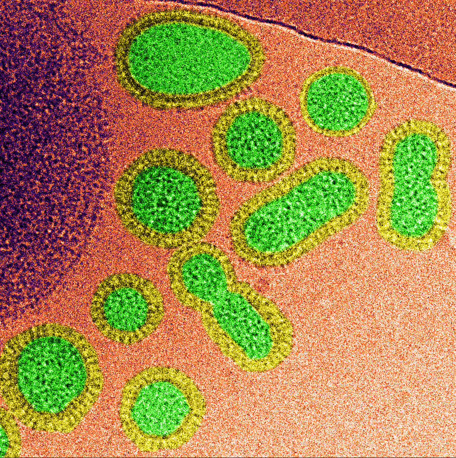 Influenza A H1n1 Virus, Cryoem Photograph by Science Source | Pixels