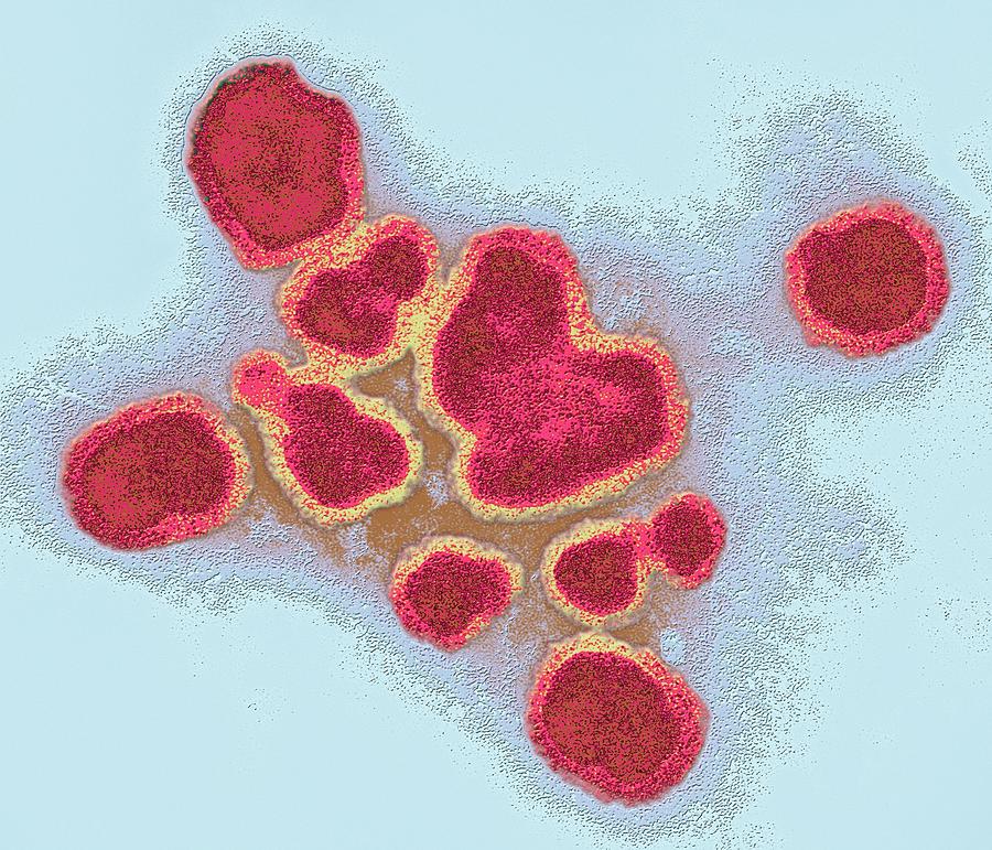 Pathogen Photograph - Influenza A Virus Particles by Ami Images/science Photo Library Pathogen Photograph - Influenza A Virus Particles by Ami Images/science Photo Library