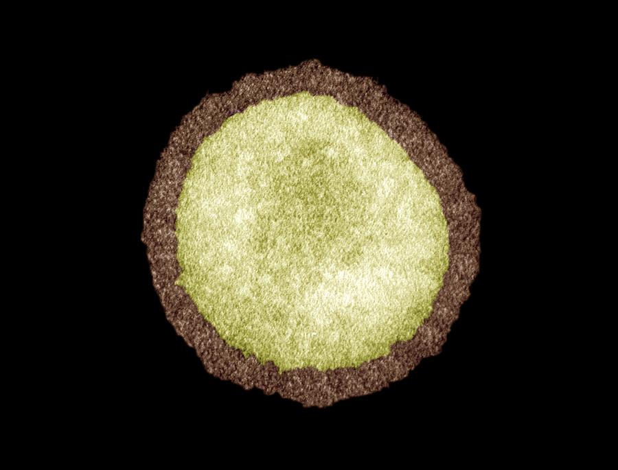 Influenza Virus Particle, TEM Photograph By Science Photo Library ...