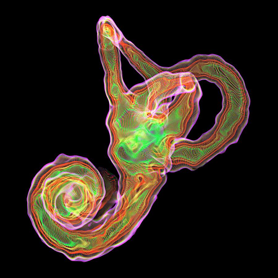 Inner Ear Structures Photograph by K H Fung/science Photo Library
