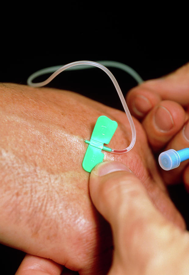 Inserting Butterfly Cannula Into Vein Photograph by Adam Hart-davis/science Photo Library