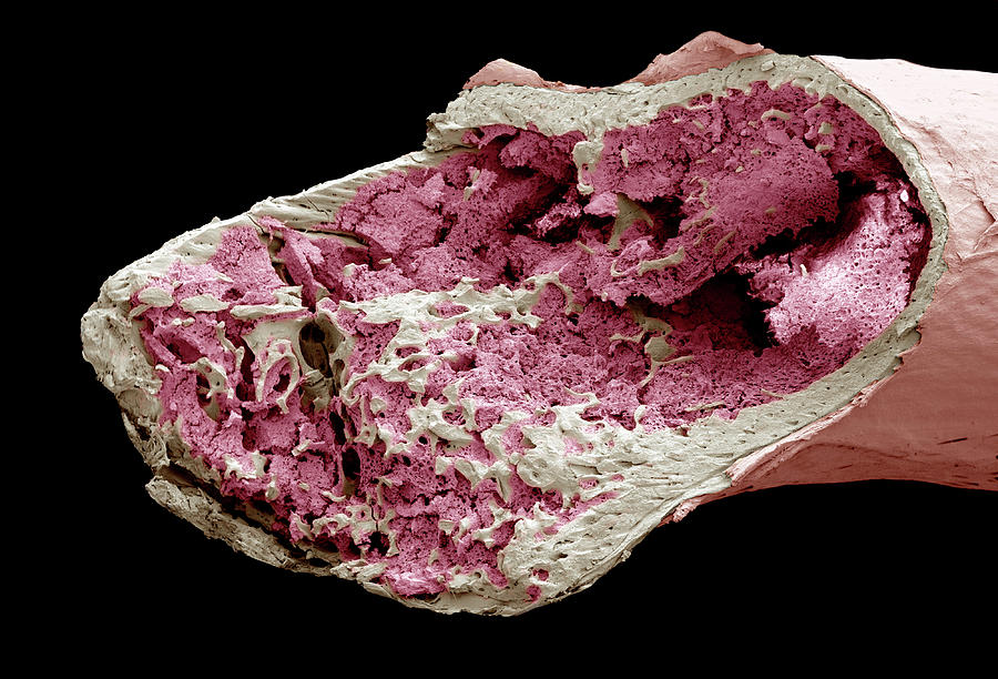 Interior Of A Bone Photograph by Steve Gschmeissner
