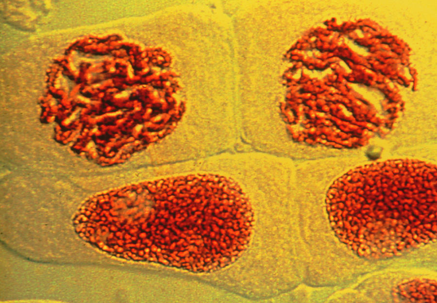 Interphase Of Mitosis In Bluebell Cells Photograph by Pr. G Gimenez-martin/science Photo Library