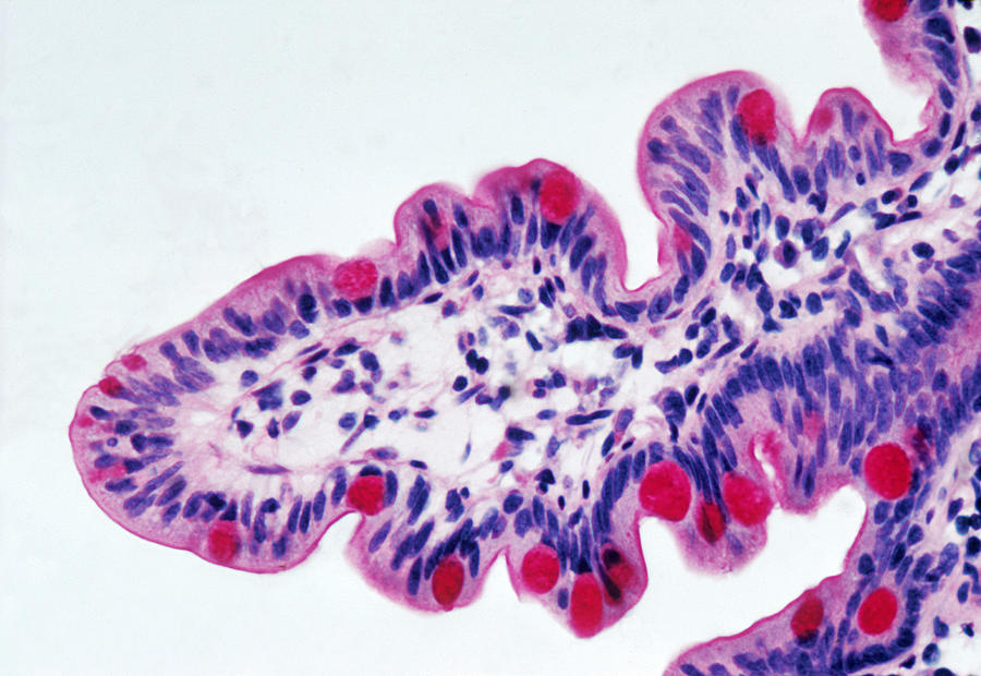 Histology Photograph - Intestinal Epithelium Lm by Marshall Sklar