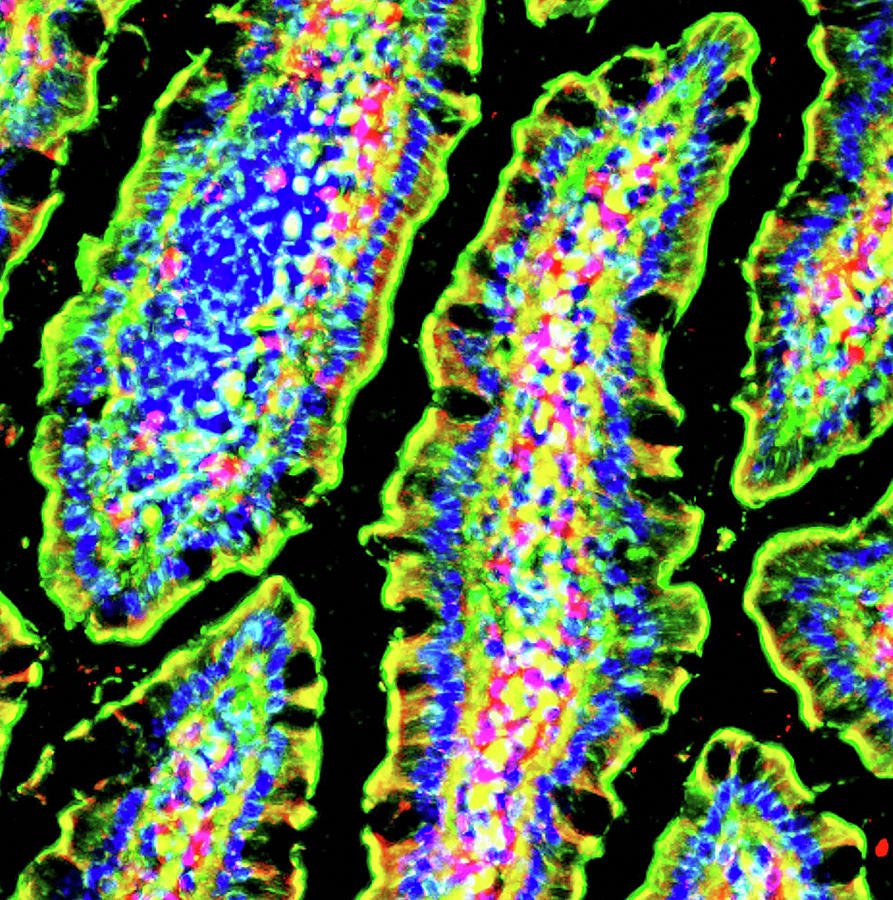 Intestinal Goblet Cells Photograph by R. Bick, B. Poindexter, Ut Medical School