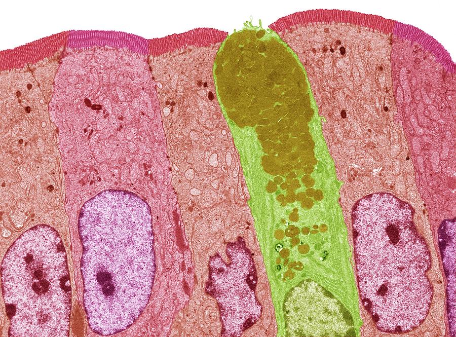 Intestinal Lining Photograph by Steve Gschmeissner/science Photo Library