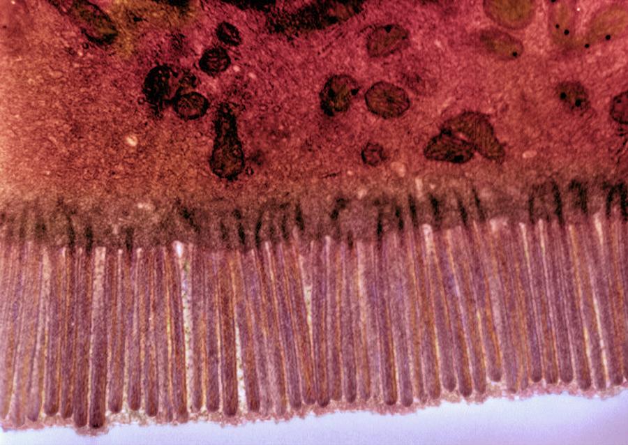 Intestinal Microvilli