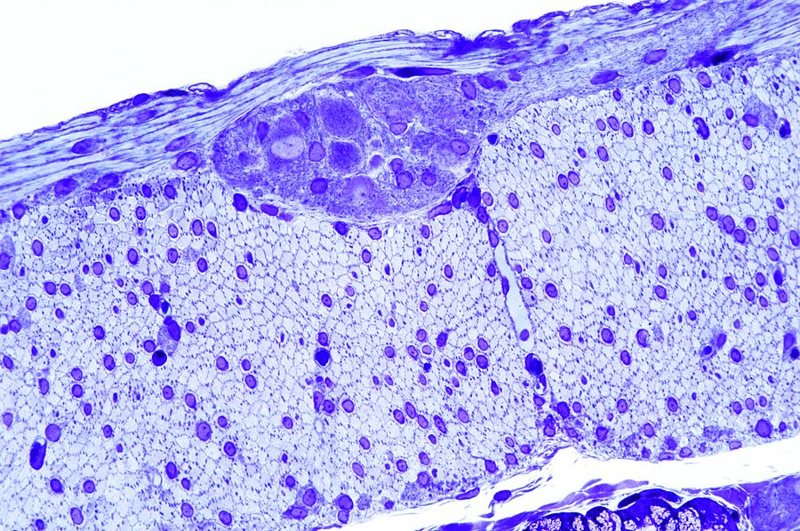 Tissue Photograph - Intestinal Nerves by Microscape Tissue Photograph - Intestinal Nerves by Microscape