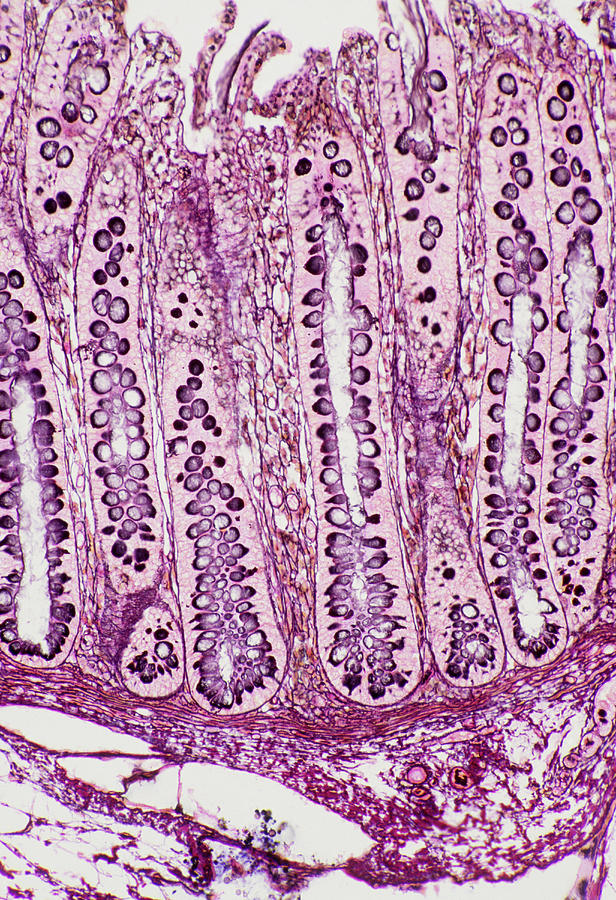 Intestinal Villi Photograph by Astrid & Hanns-frieder Michler/science Photo Library