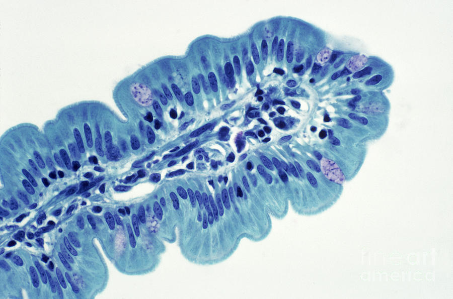 Histology Photograph - Intestinal Villi Lm by Dr. Cecil H. Fox