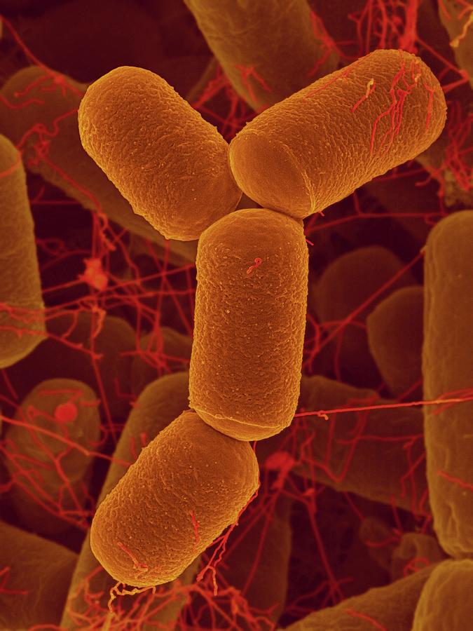 Intestine Archaea Methanobrevibacter Smithii Photograph by Dennis ...