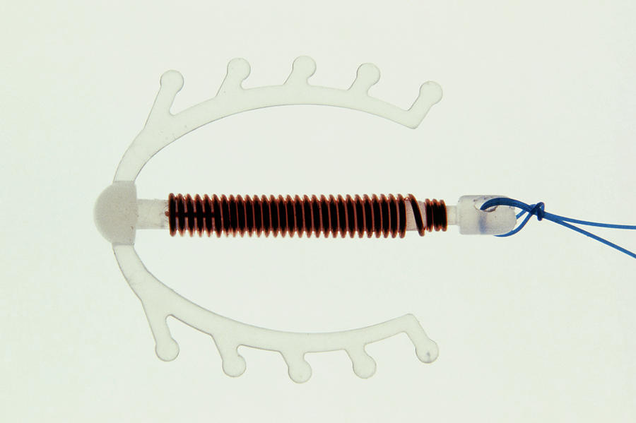 Intrauterine Device Photograph - Intrauterine Contraceptive Device by Klaus Guldbrandsen/science Photo Library