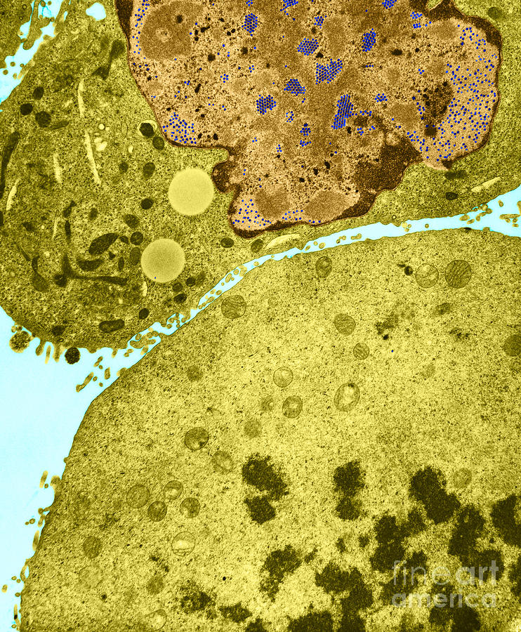 Kb Cell Infected With Adenovirus Tem Photograph by David M. Phillips