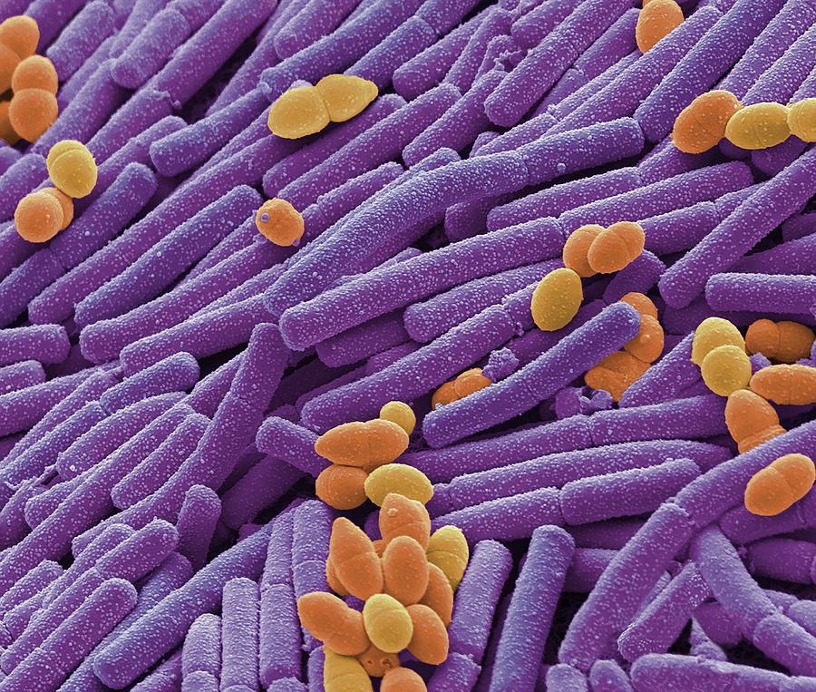 Kefir Bacteria Photograph by Steve Gschmeissner/science Photo Library ...