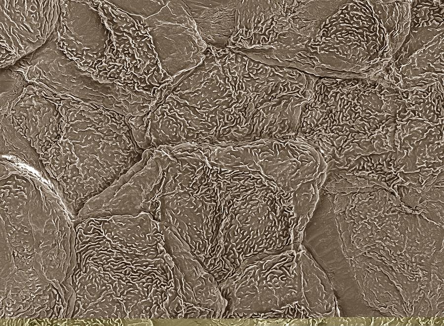 Keratinocyte skin cells, SEM Photograph by Science Photo Library - Pixels