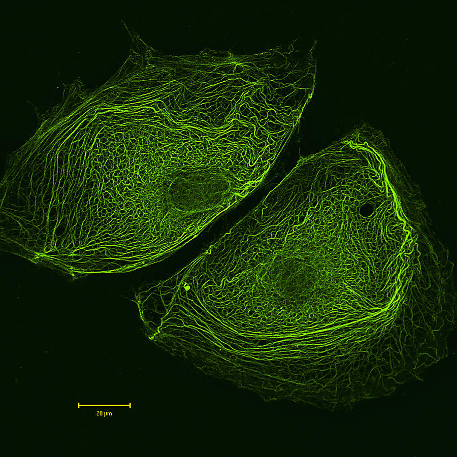 Keratinocytes Lm Photograph by Alvin Telser