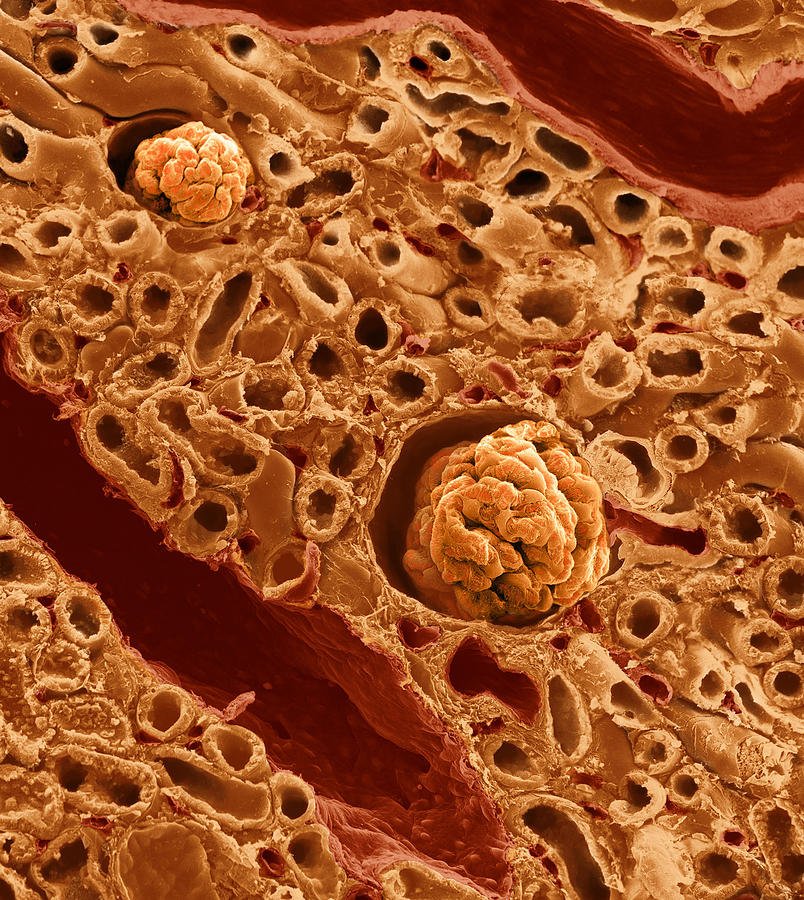 Kidney Cross Section, Sem Photograph by Anatomical Travelogue