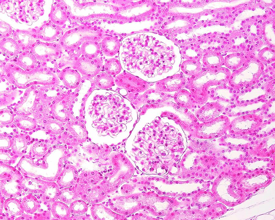 Kidney Glomeruli Photograph by Jose Calvo / Science Photo Library