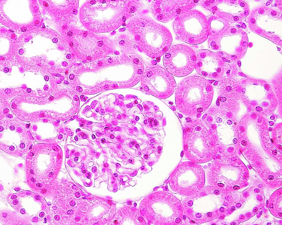 Kidney Glomerulus Photograph by Jose Calvo / Science Photo Library