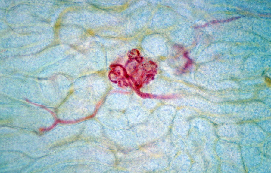 Kidney, Glomerulus, Lm Photograph by Michael Abbey