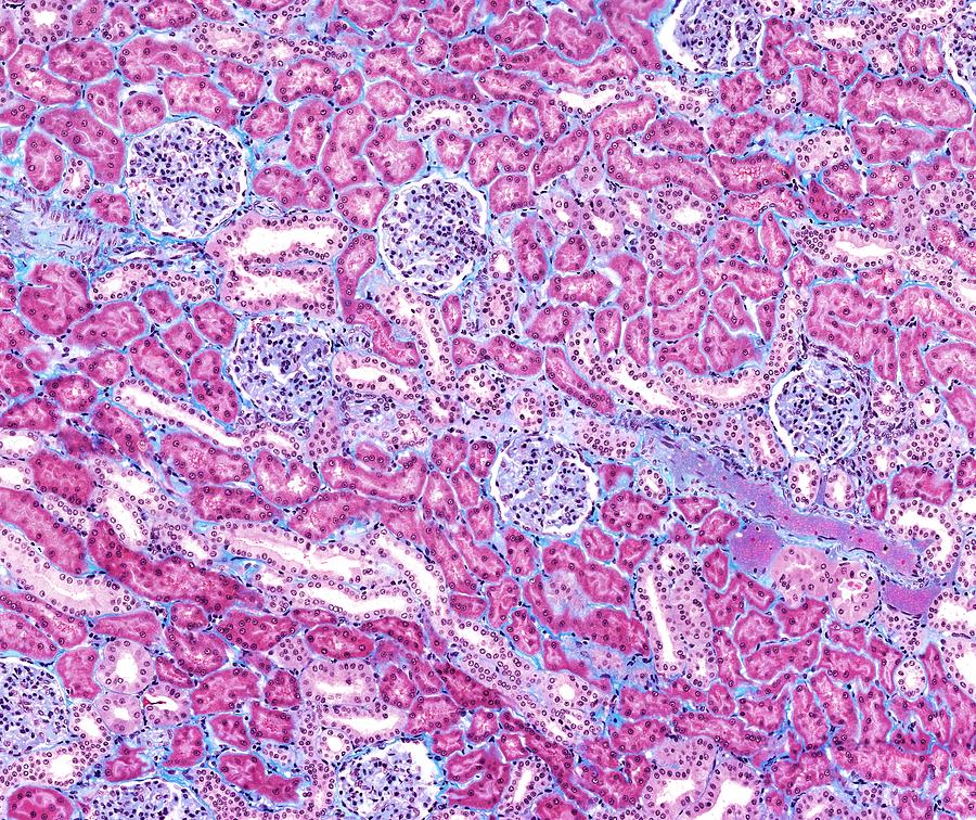 Glomerulus Photograph - Kidney by Microscape