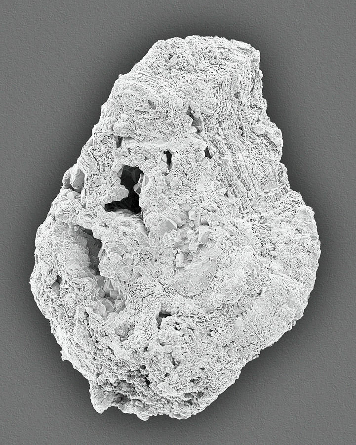 Kidney Stone Photograph by Dennis Kunkel Microscopy/science Photo Library