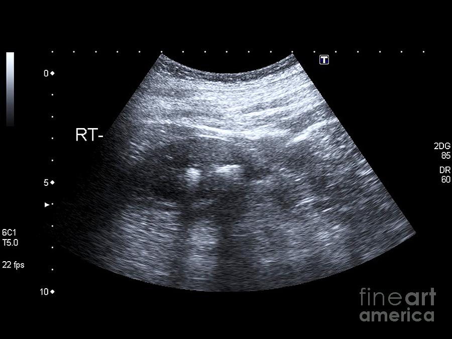 ultrasound science