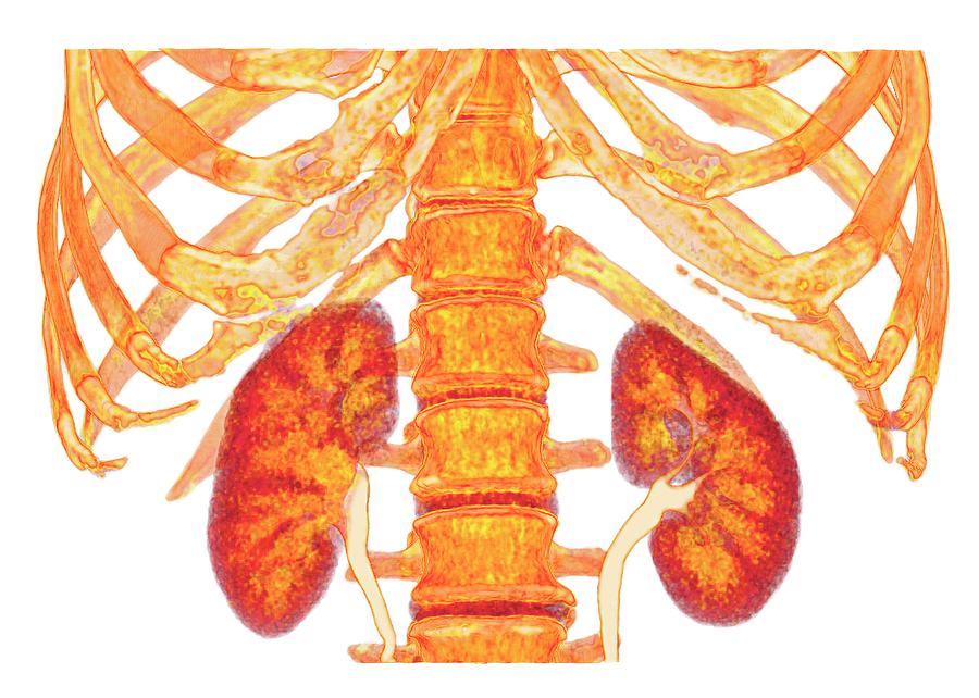 Kidneys And Spine And Ribs Photograph by K H Fung/science Photo Library