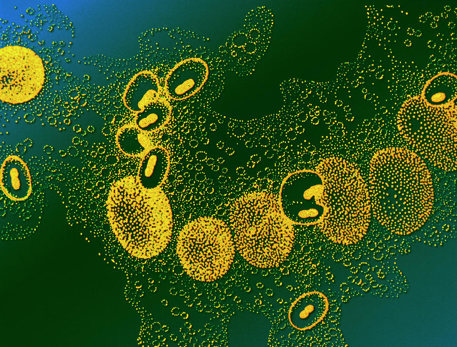 Klebsiella Pneumoniae Bacteria Photograph By Alfred Pasieka Science Photo Library Pixels Merch