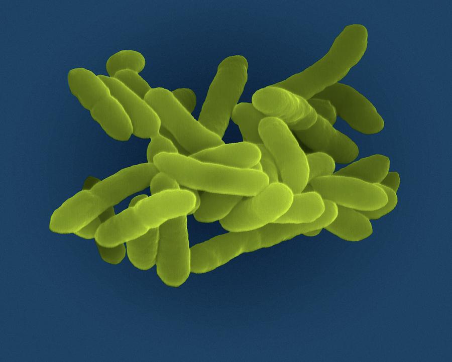 Klebsiella Pneumoniae Photograph by Dennis Kunkel Microscopy/science Photo Library