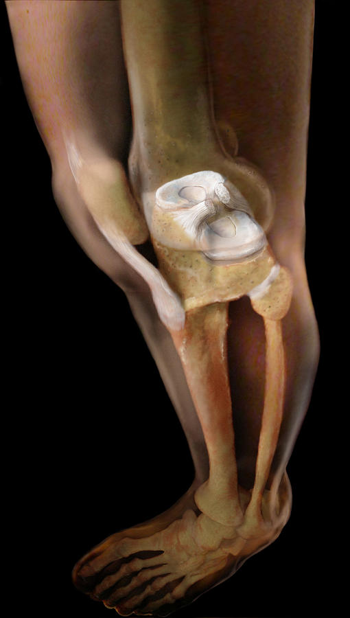 Knee And Menisci Photograph by Anatomical Travelogue - Pixels