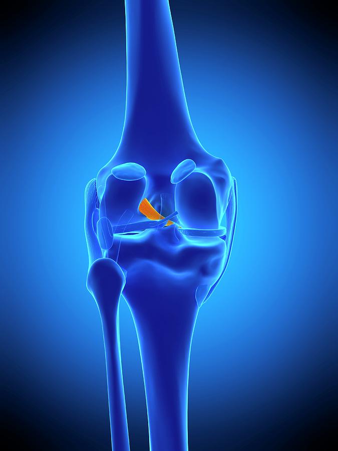 Knee Ligament Photograph by Sebastian Kaulitzki/science Photo Library
