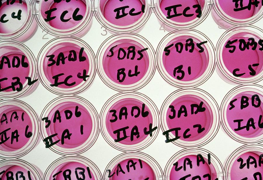 Labelled Wells Used For Tissue Cultures Photograph by National Cancer Institute/science Photo Library