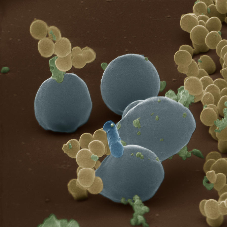 Lactic Acid Bacteria And Yeast Photograph by Eye of Science