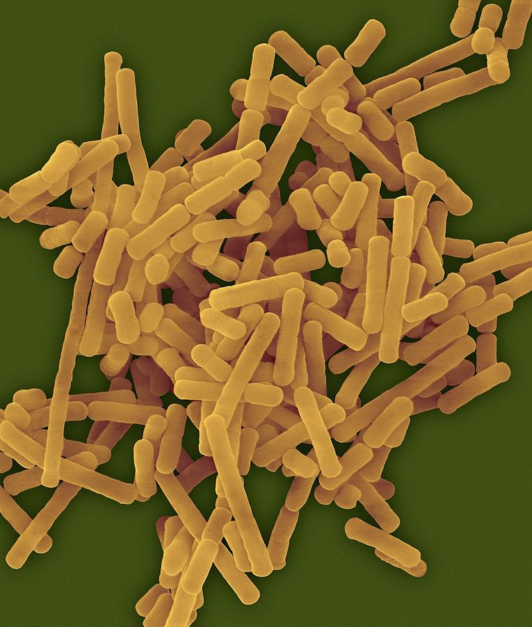 Lactobacillus Buchneri Photograph By Dennis Kunkel Microscopyscience Photo Library 7313