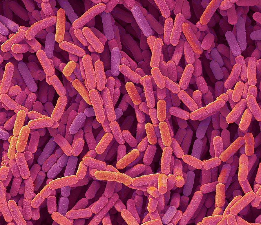 Lactobacillus Rhamnosus Bacteria by Steve Gschmeissner/science Photo Library