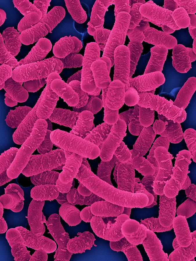 Lactobacillus Photograph - Lactobacillus Salivarius by Dennis Kunkel Microscopy/science Photo Library