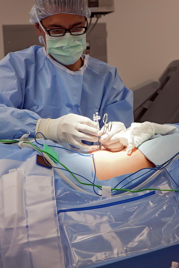 Laparoscopic Robotic Cancer Surgery Photograph by Jim West - Pixels