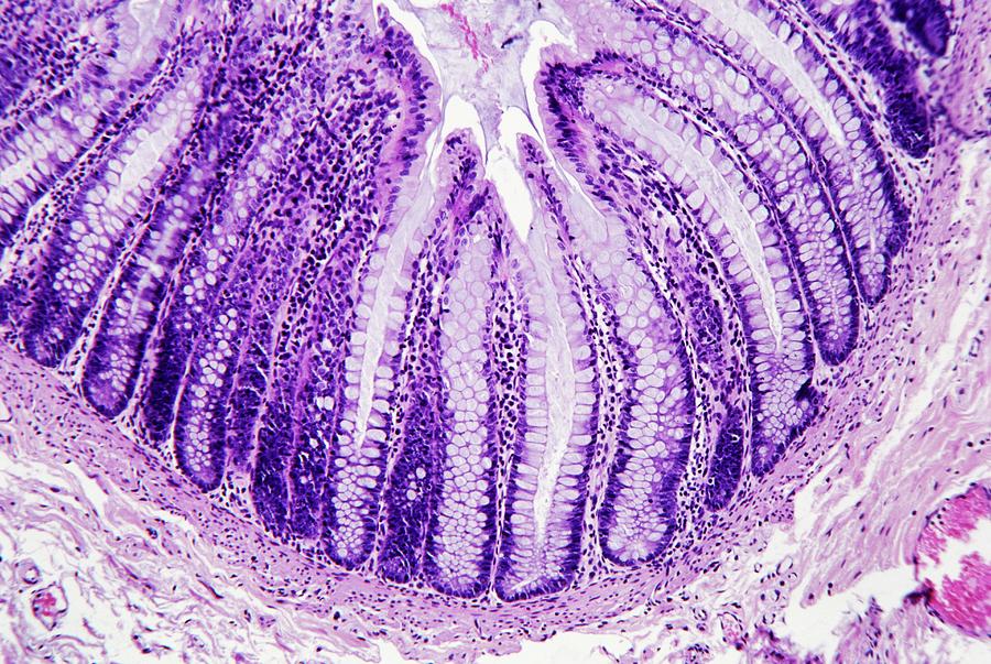 Tissue Photograph - Large Intestine Lining by Microscape