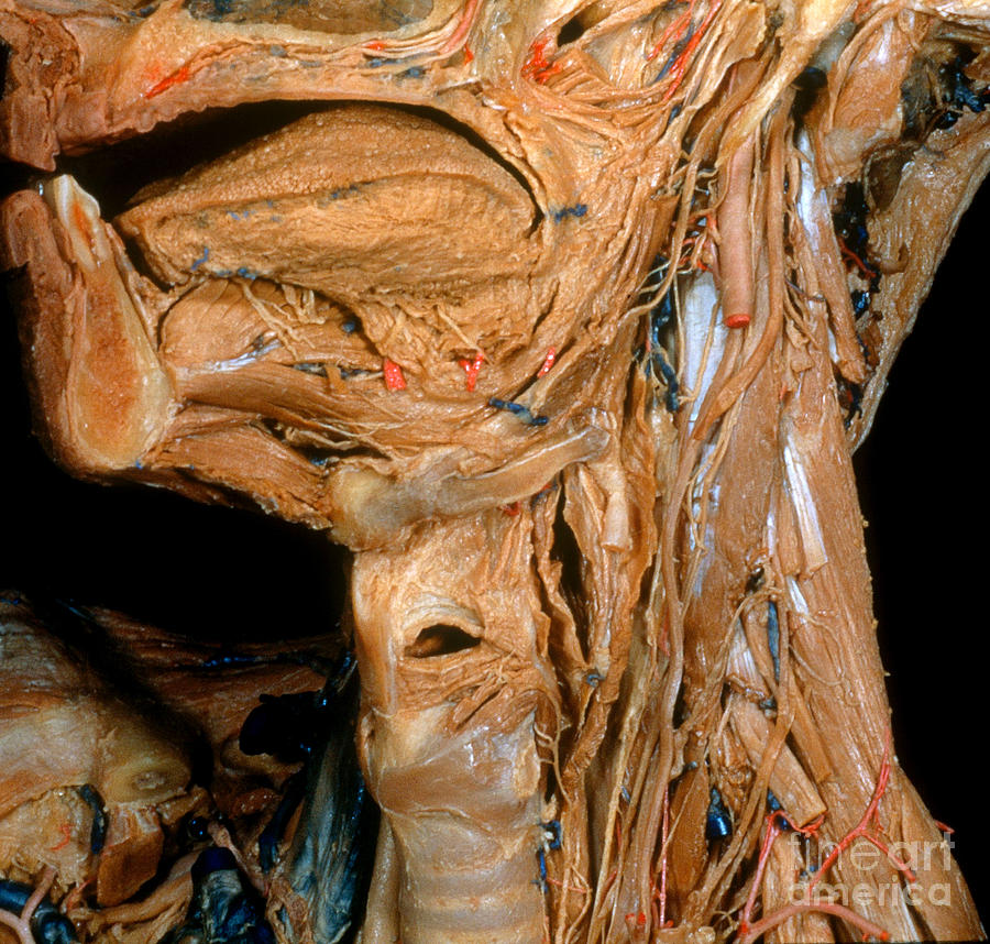 Larynx Photograph by VideoSurgery