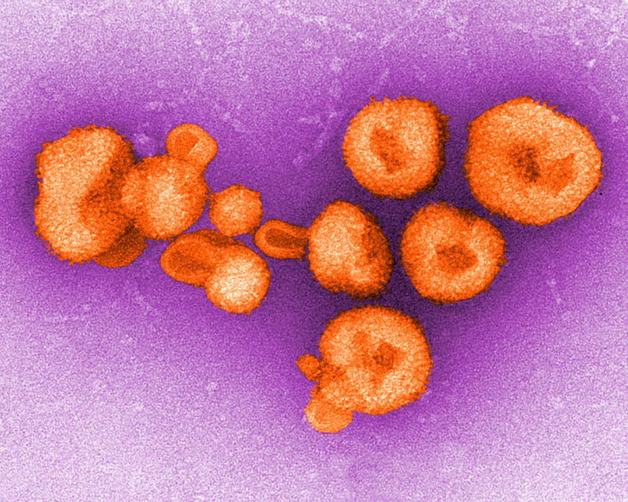 Lassa Virus, Tem Photograph by Science Source