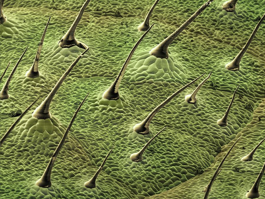 Leaf Hairs Photograph by Martin Oeggerli/science Photo Library